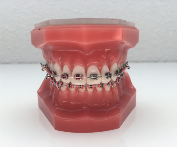 orthodontie